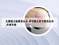 儿童腿上起癣怎么办 孩子腿上长了癣怎么办,不疼不痒