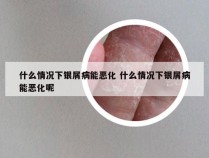 什么情况下银屑病能恶化 什么情况下银屑病能恶化呢