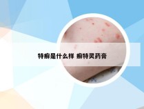 特癣是什么样 癣特灵药膏