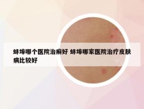 蚌埠哪个医院治癣好 蚌埠哪家医院治疗皮肤病比较好