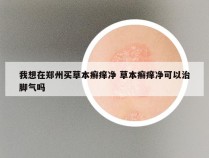 我想在郑州买草本癣痒净 草本癣痒净可以治脚气吗