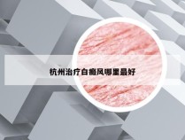 杭州治疗白癜风哪里最好