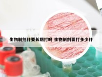 生物制剂针要长期打吗 生物制剂要打多少针