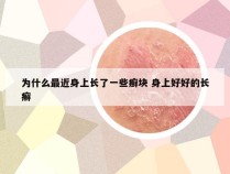 为什么最近身上长了一些癣块 身上好好的长癣