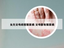 女方父母歧视银屑病 父母都有银屑病