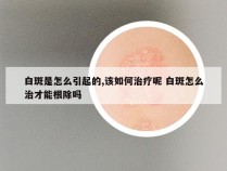 白斑是怎么引起的,该如何治疗呢 白斑怎么治才能根除吗