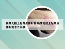 新生儿脸上起白点像粉刺 新生儿脸上起白点像粉刺怎么回事