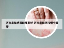 河南皮肤病医院那家好 河南皮肤医院哪个最好