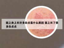 腿上身上长许多白点是什么原因 腿上长了很多白点点