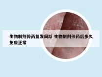 生物制剂停药复发周期 生物制剂停药后多久免疫正常