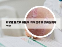 石家庄看皮肤病医院 石家庄看皮肤病医院哪个好