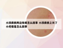 小孩肩膀两边有癣怎么回事 小孩肩膀上长了小疙瘩是怎么回事