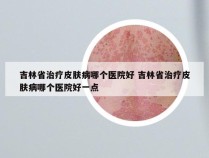 吉林省治疗皮肤病哪个医院好 吉林省治疗皮肤病哪个医院好一点