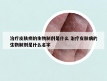 治疗皮肤病的生物制剂是什么 治疗皮肤病的生物制剂是什么名字