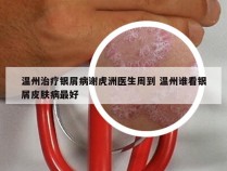 温州治疗银屑病谢虎洲医生周到 温州谁看银屑皮肤病最好