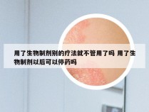 用了生物制剂别的疗法就不管用了吗 用了生物制剂以后可以停药吗