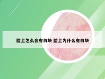 脸上怎么会有白块 脸上为什么有白块