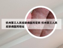 杭州第三人民皮肤病医院官网 杭州第三人民皮肤病医院地址