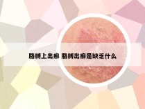 胳膊上出癣 胳膊出癣是缺乏什么