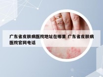 广东省皮肤病医院地址在哪里 广东省皮肤病医院官网电话