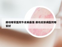 廊坊哪家医院牛皮癣最强 廊坊皮肤病医院哪家好