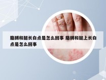 胳膊和腿长白点是怎么回事 胳膊和腿上长白点是怎么回事