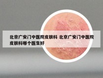 北京广安门中医院皮肤科 北京广安门中医院皮肤科哪个医生好