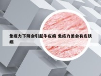 免疫力下降会引起牛皮癣 免疫力差会有皮肤病