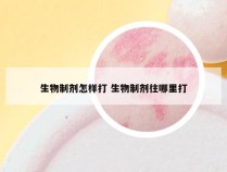 生物制剂怎样打 生物制剂往哪里打