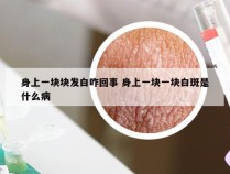 身上一块块发白咋回事 身上一块一块白斑是什么病