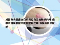 成都市衣冠庙立交桥周边有治皮肤病的吗 成都衣冠庙肿瘤中医院地址在哪 诚推高新中医好