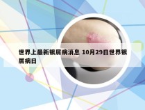 世界上最新银屑病消息 10月29日世界银屑病日