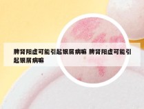 脾肾阳虚可能引起银屑病嘛 脾肾阳虚可能引起银屑病嘛