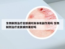 生物制剂治疗皮肤病对身体有副作用吗 生物制剂治疗皮肤病效果好吗