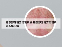 腿部部分地方出现白点 腿部部分地方出现白点不痛不痒