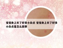 宝宝身上长了好多小白点 宝宝身上长了好多小白点是怎么回事