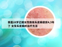 我是28岁已婚女性我有头皮癣症状4,5年了 女生头皮癣的治疗方法