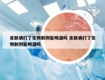 皮肤病打了生物制剂能喝酒吗 皮肤病打了生物制剂能喝酒吗