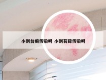 小刺台癣传染吗 小刺苔藓传染吗