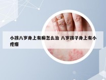 小孩八岁身上有癣怎么治 八岁孩子身上有小疙瘩