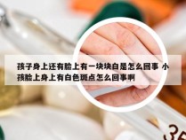 孩子身上还有脸上有一块块白是怎么回事 小孩脸上身上有白色斑点怎么回事啊