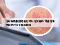 注射生物制剂可善挺可以吃海鲜吗 可善挺生物制剂对生育有影响吗