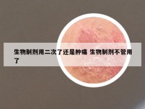 生物制剂用二次了还是肿痛 生物制剂不管用了