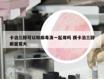 卡泊三醇可以和癣毒清一起用吗 摸卡泊三醇癣面变大