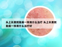 头上长黑斑象癣一样用什么治疗 头上长黑斑象癣一样用什么治疗好