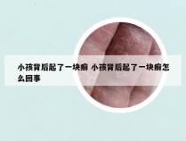 小孩背后起了一块癣 小孩背后起了一块癣怎么回事