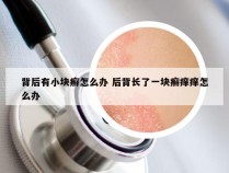 背后有小块癣怎么办 后背长了一块癣痒痒怎么办