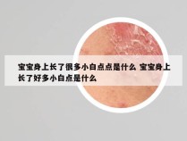 宝宝身上长了很多小白点点是什么 宝宝身上长了好多小白点是什么