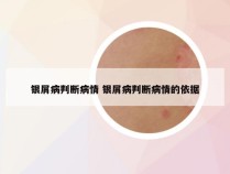 银屑病判断病情 银屑病判断病情的依据