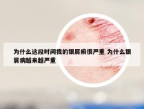 为什么这段时间我的银屑癣很严重 为什么银屑病越来越严重